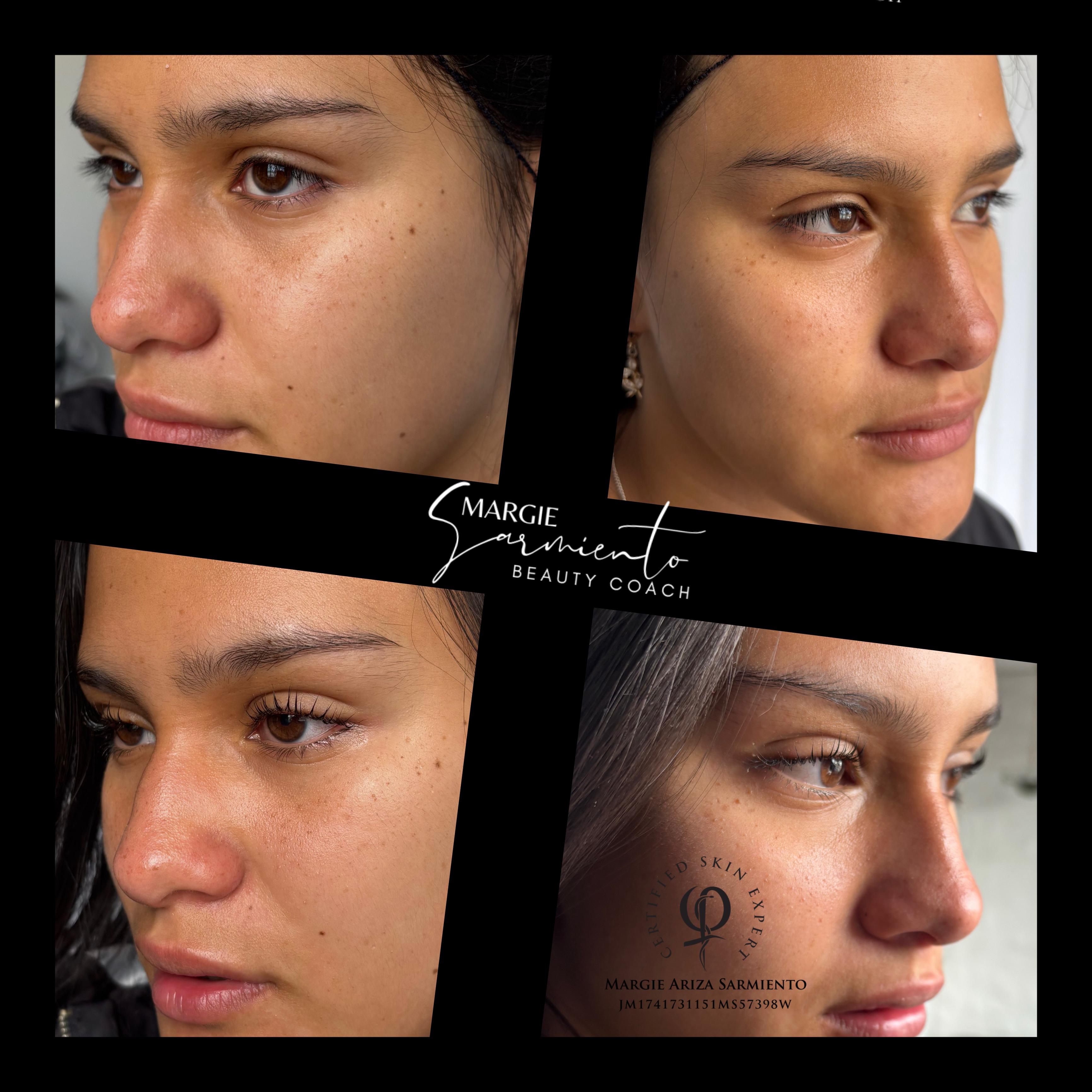 Micropigmentación de cejas - Caso 01