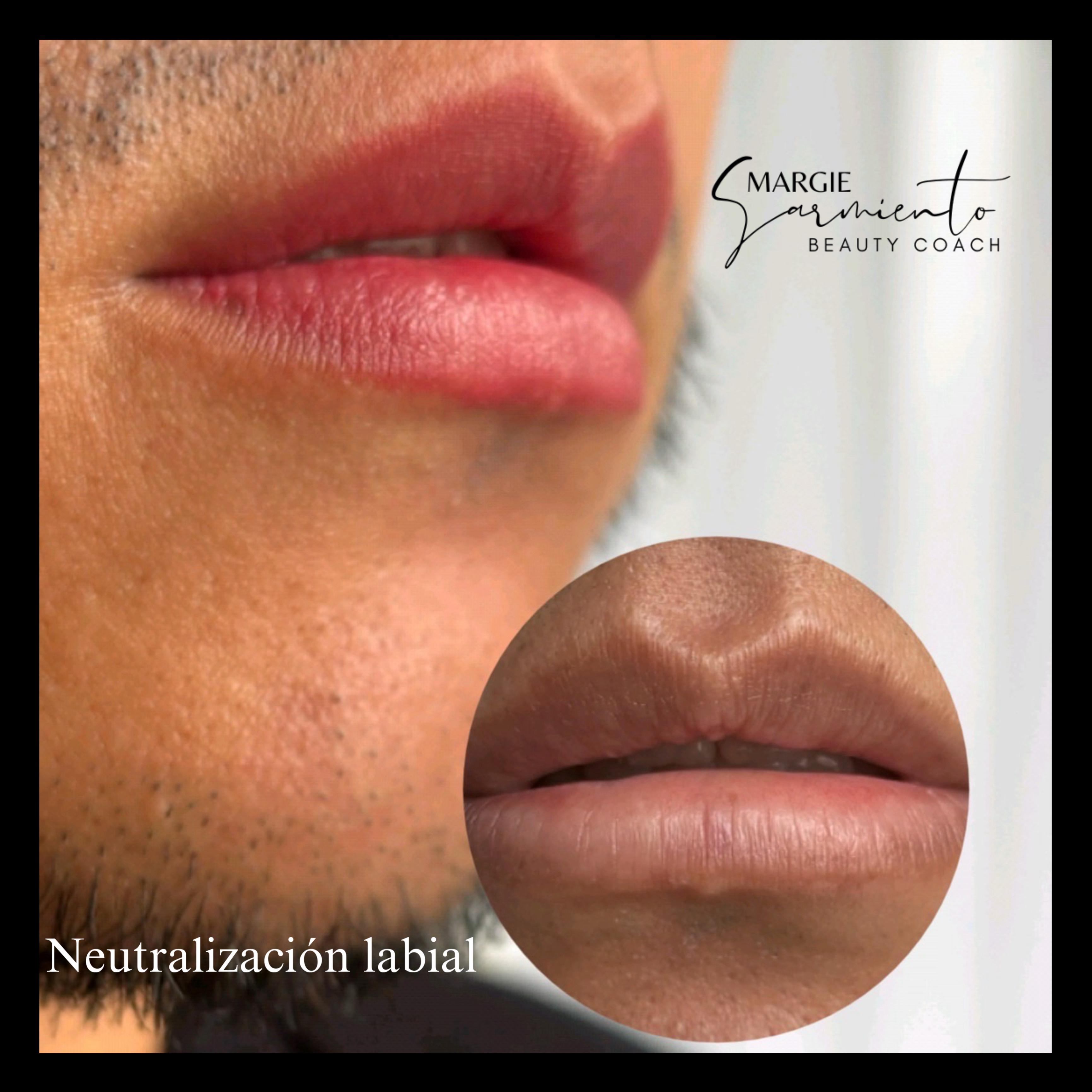 Micropigmentación de labios - Caso 01
